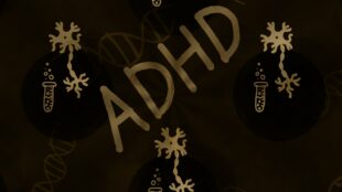 Is Adult ADHD Real? Most Common Misunderstandings About ADHD Explained 2